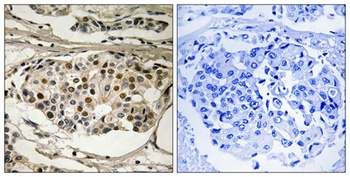NFκB-p65 (phospho Ser281) rabbit pAb
