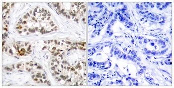 RelB (phospho Ser552) rabbit pAb
