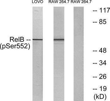 RelB (phospho Ser552) rabbit pAb