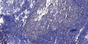 Renin rabbit pAb
