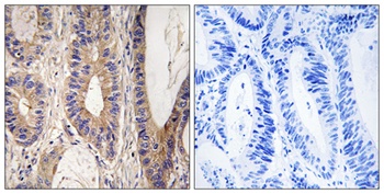 Rent1 rabbit pAb Antibody