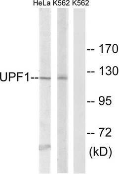 Rent1 rabbit pAb Antibody