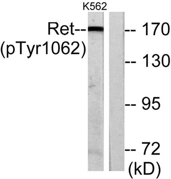 Ret (phospho Tyr1062) rabbit pAb