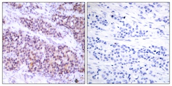 Bcl-x (phospho Ser62) rabbit pAb