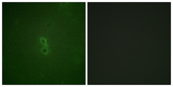 Bcl-x (phospho-Thr47) antibody