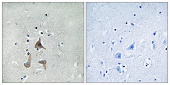 RGR antibody