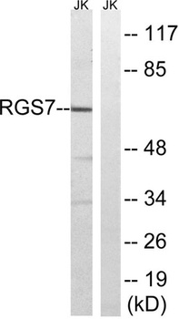 RGS7 rabbit pAb
