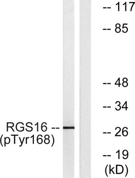 RGS16 (phospho Tyr168) rabbit pAb