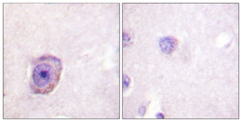 Rhodopsin (phospho-Ser334) antibody