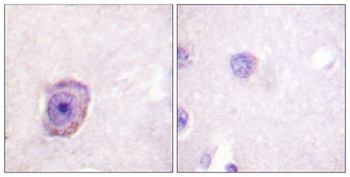 Rhodopsin (phospho Ser334) rabbit pAb