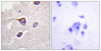 GRK 1 (phospho Ser21) rabbit pAb