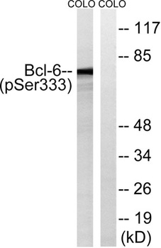 Bcl-6 (phospho Ser333) rabbit pAb