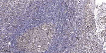 Bcl-6 rabbit pAb