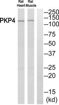 Plakophilin 4 antibody