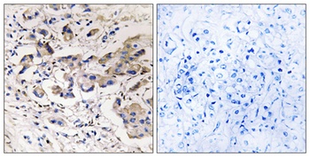 Plakophilin 4 rabbit pAb