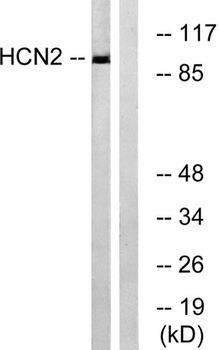 HCN2 rabbit pAb Antibody