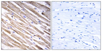 Ribosomal Protein L3L antibody