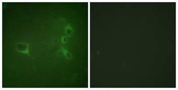 Bcr (phospho Tyr360) rabbit pAb