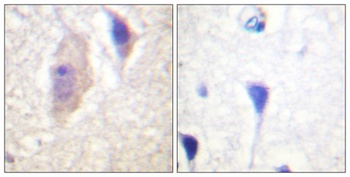 Bcr (phospho-Tyr360) antibody