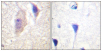 Bcr (phospho Tyr360) rabbit pAb