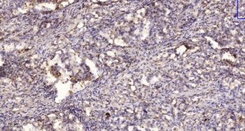 Ribosomal Protein L11 rabbit pAb