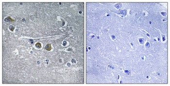 Ribosomal Protein L15 rabbit pAb