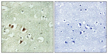 Ribosomal Protein L15 rabbit pAb