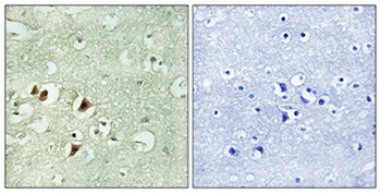 Ribosomal Protein L15 antibody