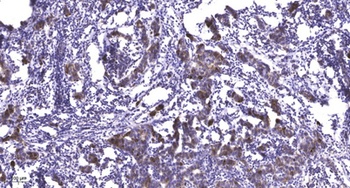 Ribosomal Protein S5 rabbit pAb