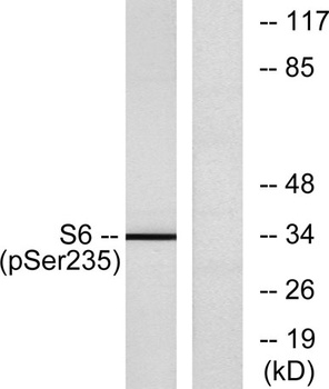 Ribosomal Protein S6 (phospho-Ser235) antibody