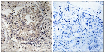 Ribosomal Protein S6 (phospho Ser235/S236) rabbit pAb
