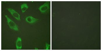Ribosomal Protein S6 (phospho Ser240) rabbit pAb