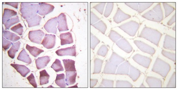 Ribosomal Protein S6 (phospho-Ser240) antibody