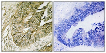 Rsk-1 (phospho Ser380) rabbit pAb