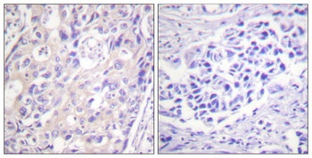Rsk-1 (phospho Thr359/S363) rabbit pAb