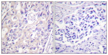 Rsk-1 (phospho-Thr359/S363) antibody