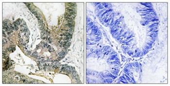 Rsk-1 rabbit pAb Antibody