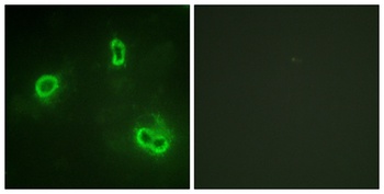 Rsk-1 antibody