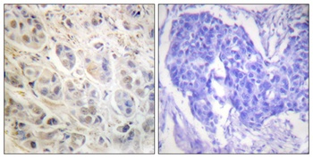 Rsk-1 antibody