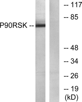 Rsk-1 rabbit pAb