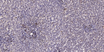p70 S6 kinase α (phospho Ser434) rabbit pAb