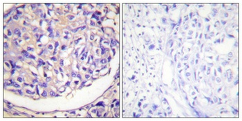 p70 S6 kinase α (phospho Thr421) rabbit pAb