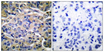 p70 S6 kinase α (phospho Thr421) rabbit pAb
