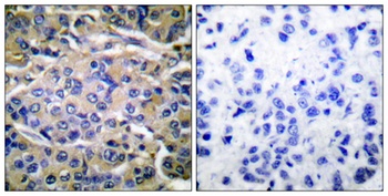 p70 S6 kinase alpha (phospho-Thr421) antibody