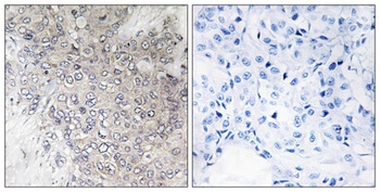 p70 S6 kinase α (phospho Thr444) rabbit pAb