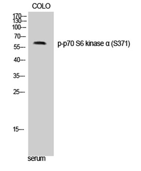 p70 S6 kinase α (phospho Ser371) rabbit pAb