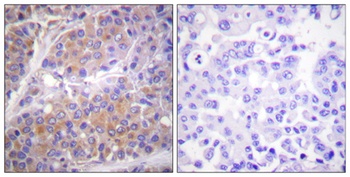 p70 S6 kinase α (phospho Ser371) rabbit pAb