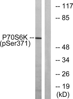 p70 S6 kinase alpha (phospho-Ser371) antibody