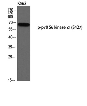 p70 S6 kinase α (phospho Ser427) rabbit pAb