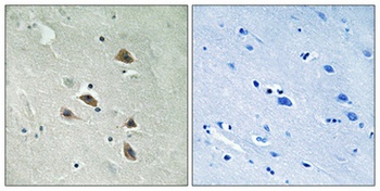 p70 S6 kinase α (phospho Ser427) rabbit pAb
